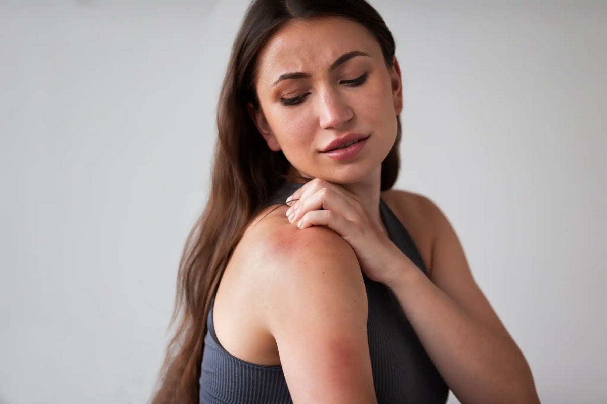Manejo del eczema mediante el control de la inflamación